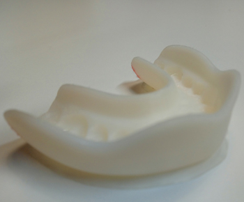 XL14_InnovationXLMouthGuard_foto1