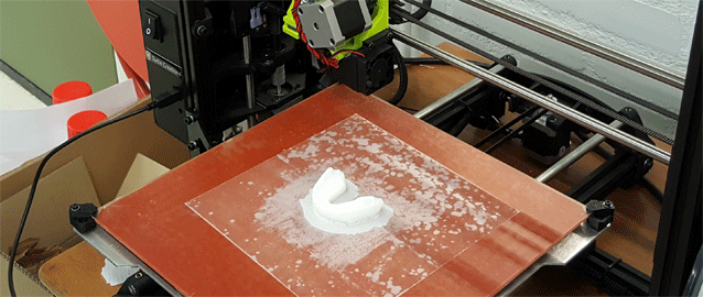 foto-XL14_InnovationXL_MouthGuard_foto4