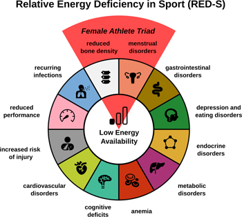 XL19TopsportMindYou-JS-1